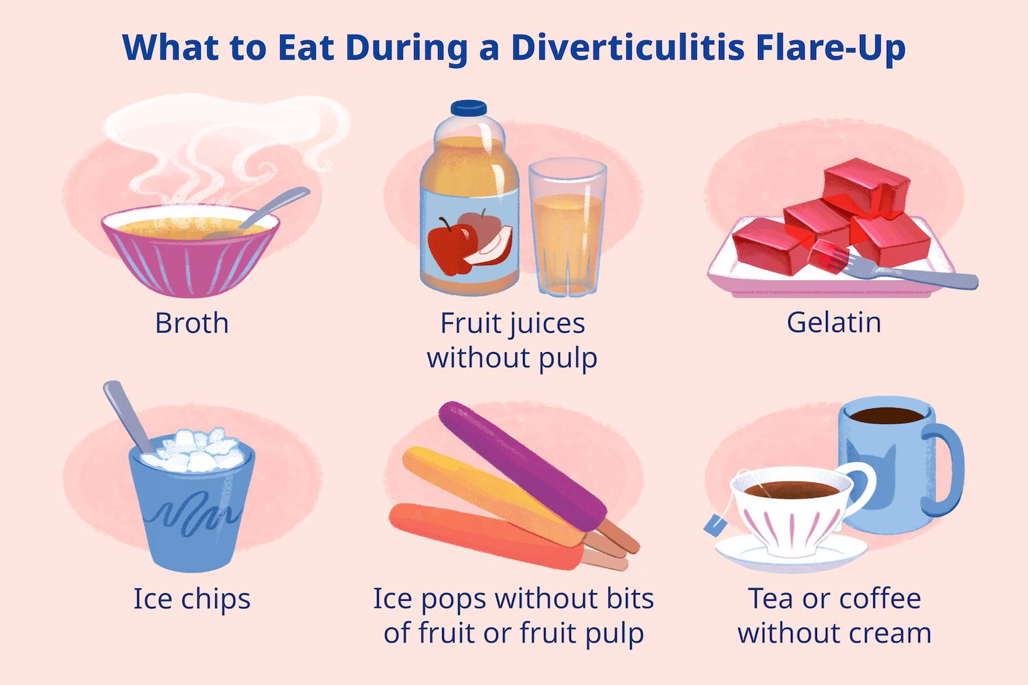 Diverticulitis Diet: Foods To Eat And Avoid with regard to Printable List of FoodsAvoid With Diverticulitis