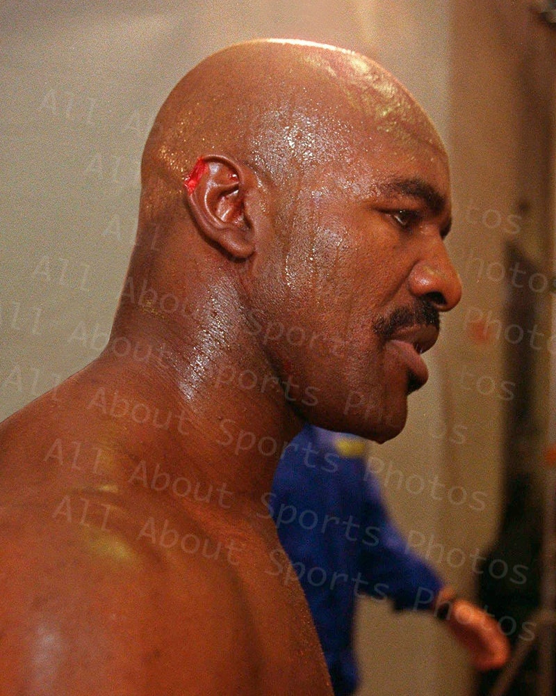 Evander Holyfield&amp;#039;S Ear After Mike Tyson Took A Bite - Etsy throughout Mike Bites - Printable Ad