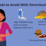 Foods To Avoid With Diverticulitis Inside Printable List Of FoodsAvoid With Diverticulitis